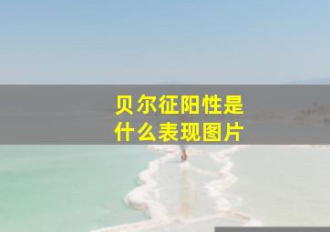 贝尔征阳性是什么表现图片